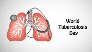 Gejala dan Cara Mengatasi Penyakit Tuberkulosis 2023